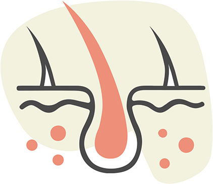 Coarse Hair and Hair Loss