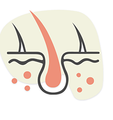 Cheveux grossiers et perte de cheveux